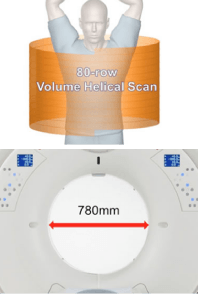 CT検査(マルチスライスCT)