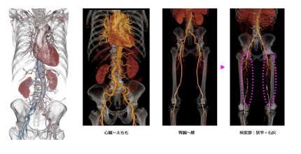 造影剤使用-検査の副産物