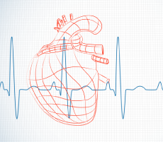 ホルター心電図検査