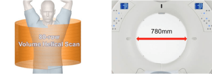 CT検査(マルチスライスCT)